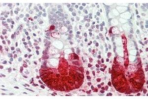 anti-Regenerating Islet-Derived 3 alpha (REG3A) (AA 40-164) antibody