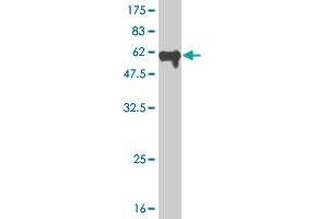Western Blot detection against Immunogen (59. (MEOX2 anticorps  (AA 1-303))