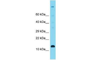 Host: Rabbit Target Name: C12orf23 Sample Type: Fetal Heart lysates Antibody Dilution: 1. (C12ORF23 anticorps  (C-Term))