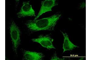 Immunofluorescence of monoclonal antibody to CAST on HeLa cell. (Calpastatin anticorps  (AA 582-669))