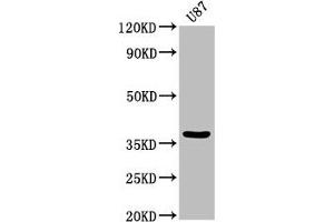 Western Blot Positive WB detected in: U87 whole cell lysate All lanes: GJD2 antibody at 3. (GJD2 anticorps  (AA 99-197))