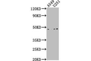 Western Blot Positive WB detected in: A549 whole cell lysate, U251 whole cell lysate All lanes: B4GALT6 antibody at 1:1000 Secondary Goat polyclonal to rabbit IgG at 1/50000 dilution Predicted band size: 45, 41 kDa Observed band size: 45 kDa