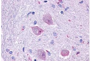Anti-CHRM4 antibody  ABIN1048444 IHC staining of human brain, neurons and glia. (CHRM4 anticorps  (Cytoplasmic Domain))