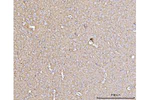 IHC analysis of DBN1 using anti-DBN1 antibody (ABIN7602637). (DBN1 anticorps  (AA 9-649))