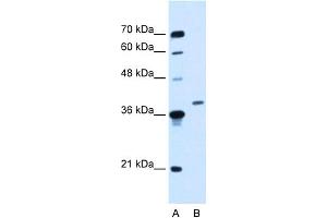 WB Suggested Anti-HOXD11 Antibody Titration:  0. (HOXD11 anticorps  (Middle Region))
