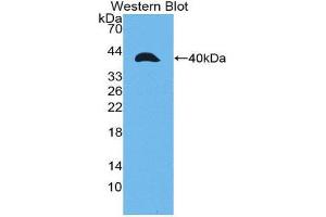 Western Blotting (WB) image for anti-Matrix Metalloproteinase 23A (MMP23A) (AA 71-383) antibody (ABIN1980456) (MMP23A anticorps  (AA 71-383))
