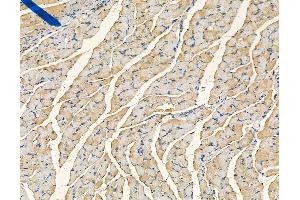 ABIN6265333 and ABIN6278532 at 1/100 staining mouse ovarian tissue by IHC-P. (STEAP1 anticorps  (N-Term))
