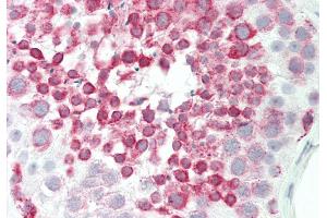 Rabbit Anti-BRD9 antibody  Formalin Fixed Paraffin Embedded Tissue: Human Testis Primary antibody Concentration: 1:100 Secondary Antibody: Donkey anti-Rabbit-Cy3 Secondary Antibody Concentration: 1:200 Magnification: 20x Exposure Time: 0.