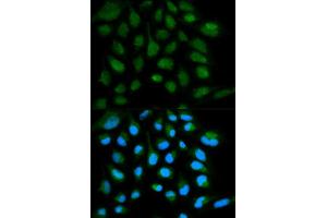 Immunofluorescence analysis of HeLa cell using SH2D1A antibody.
