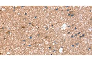 Immunohistochemistry of paraffin-embedded Human brain using STX2 Polyclonal Antibody at dilution of 1:40 (STX2 anticorps)