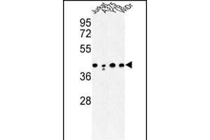 Western blot analysis of CANT1 Antibody (N-term) (ABIN652769 and ABIN2842506) in Jurkat, , Y79, WiDr cell line lysates (35 μg/lane). (CANT1 anticorps  (N-Term))