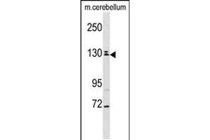 Western blot analysis in mouse cerebellum tissue lysates (35ug/lane). (TBC1D8 anticorps  (C-Term))