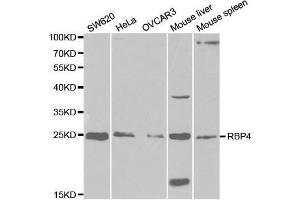 Western blot analysis of extracts of various cell lines, using RBP4 antibody. (RBP4 anticorps  (AA 19-201))
