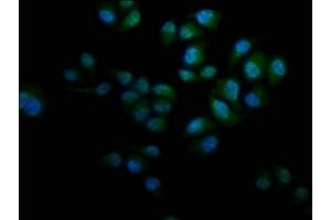 Immunofluorescence staining of Hela cells with ABIN7157376 at 1:133, counter-stained with DAPI. (KRT12 anticorps  (AA 1-178))
