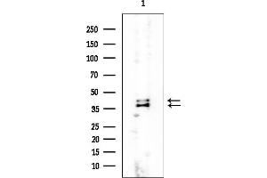 anti-Muscleblind-Like 2 (MBNL2) antibody