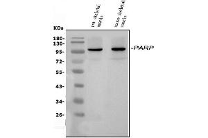 Western blot analysis of PARP9 using anti-PARP9 antibody (ABIN7599784).