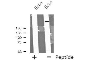 Western blot analysis of extracts from HeLa cells using MYO9B antibody. (MYO9B anticorps  (N-Term))