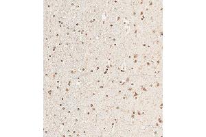 Immunohistochemical analysis of paraffin-embedded human brain tissue using (ABIN6242502 and ABIN6578624) performed on the Leica® BOND RXm. (NUP93 anticorps  (AA 20-54))