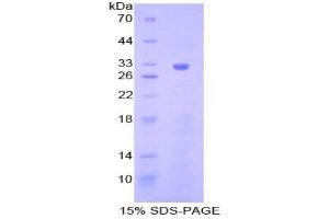 SDS-PAGE analysis of Mouse Janus Kinase 1 Protein.