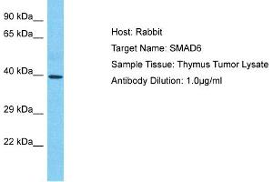 Host: Rabbit Target Name: SMAD6 Sample Type: Thymus Tumor lysates Antibody Dilution: 1. (SMAD6 anticorps  (N-Term))