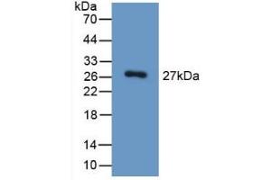 Detection of Recombinant HGD, Mouse using Polyclonal Antibody to Homogentisate-1,2-Dioxygenase (HGD) (HGD anticorps  (AA 190-429))