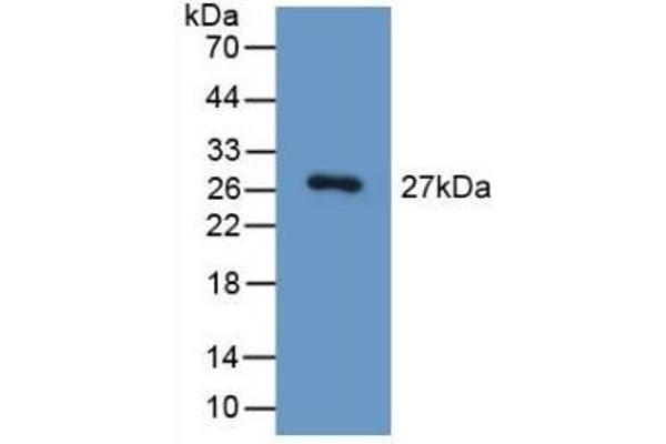 HGD anticorps  (AA 190-429)