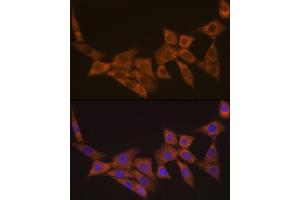 Immunofluorescence analysis of NIH-3T3 cells using DCP1A Rabbit mAb (ABIN7266678) at dilution of 1:100 (40x lens). (DCP1A anticorps)