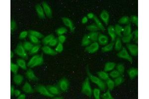 Detection of MAPRE1 in Hela cells using Polyclonal Antibody to Microtubule Associated Protein RP/EB Family, Member 1 (MAPRE1)