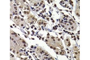 Immunohistochemistry of paraffin-embedded Human stomach using DNAJB6 Polyclonal Antibody at dilution of 1:100 (40x lens). (DNAJB6 anticorps)