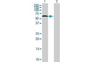Western Blot analysis of SS18 expression in transfected 293T cell line by SS18 MaxPab polyclonal antibody.