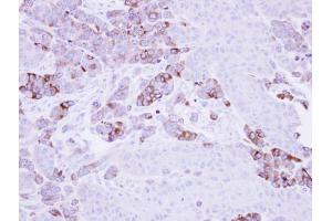 IHC-P Image Immunohistochemical analysis of paraffin-embedded SG xenograft, using Epoxide hydrolase 1, antibody at 1:500 dilution.