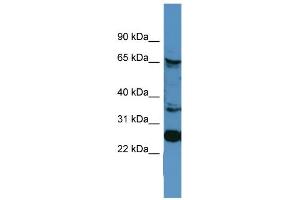 WB Suggested Anti-CANX Antibody Titration: 0. (Calnexin anticorps  (C-Term))