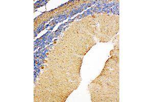 Anti-NME2 antibody, IHC(P) IHC(P): Rat Cerebellum Tissue