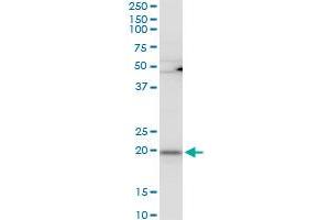 RPL21 polyclonal antibody (A01), Lot # 051220JC01. (RPL21 anticorps  (AA 2-85))