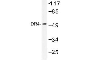 Image no. 1 for anti-Tumor Necrosis Factor Receptor Superfamily, Member 10a (TNFRSF10A) antibody (ABIN272303) (TNFRSF10A anticorps)
