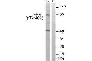 Western blot analysis of extracts from Jurkat cells, treated with starved (24hours), using FER (Phospho-Tyr402) antibody. (FER anticorps  (pTyr402))