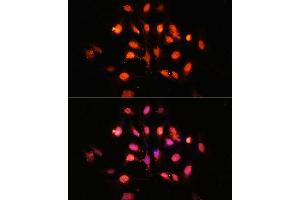 Immunofluorescence analysis of U-2 OS cells using PHLPP1 Polyclonal Antibody (ABIN6128434, ABIN6145573, ABIN6145574 and ABIN6225035) at dilution of 1:100 (40x lens).