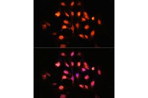 Immunofluorescence analysis of U-2 OS cells using PHLPP1 Polyclonal Antibody (ABIN6128434, ABIN6145573, ABIN6145574 and ABIN6225035) at dilution of 1:100 (40x lens). (PHLPP1 anticorps  (AA 1508-1717))