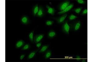 Immunofluorescence of monoclonal antibody to NEK3 on HeLa cell.