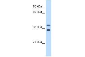 WB Suggested Anti-GDE1 Antibody Titration:  0. (GDE1 anticorps  (N-Term))