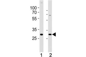 Western blot analysis of lysate from (1) SH-SY5Y and (2) MCF-7 cell line using HES1 antibody at 1:1000.