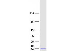Validation with Western Blot