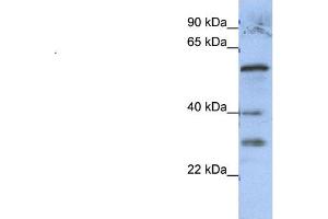 WB Suggested Anti-GADL1  Antibody Titration: 0. (GADL1 anticorps  (Middle Region))