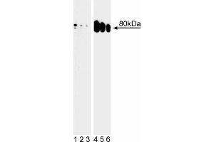 Western blot analysis of Ezrin (pT567) in human epidermis. (Ezrin anticorps  (pThr567))