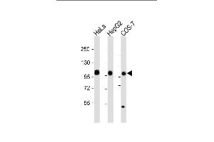 All lanes : Anti-MET/HGFR Antibody at dilution Lane 1: HeLa whole cell lysate Lane 2: HepG2 whole cell lysate Lane 3: COS-7 whole cell lysate Lysates/proteins at 20 μg per lane. (c-MET anticorps  (Catalytic Domain))