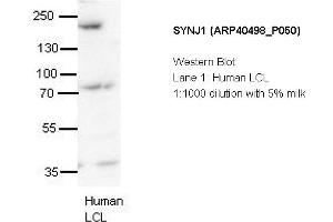 Image no. 2 for anti-Synaptojanin 1 (SYNJ1) (N-Term) antibody (ABIN2778875) (Synaptojanin 1 anticorps  (N-Term))