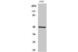 Western Blotting (WB) image for anti-Inhibitor of kappa Light Polypeptide Gene Enhancer in B-Cells, Kinase gamma (IKBKG) (Internal Region) antibody (ABIN6282660)