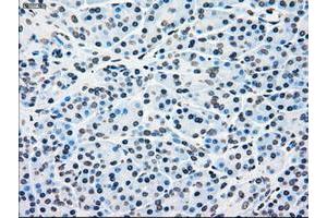 Image no. 8 for anti-B-Raf proto-oncogene, serine/threonine kinase (BRAF) antibody (ABIN1496951)