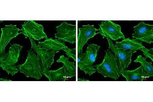 ICC/IF Image beta Actin antibody detects beta Actin protein at cytoskeleton by immunofluorescent analysis.