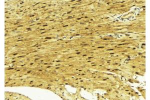 ABIN6269312 at 1/100 staining Mouse muscle tissue by IHC-P.
